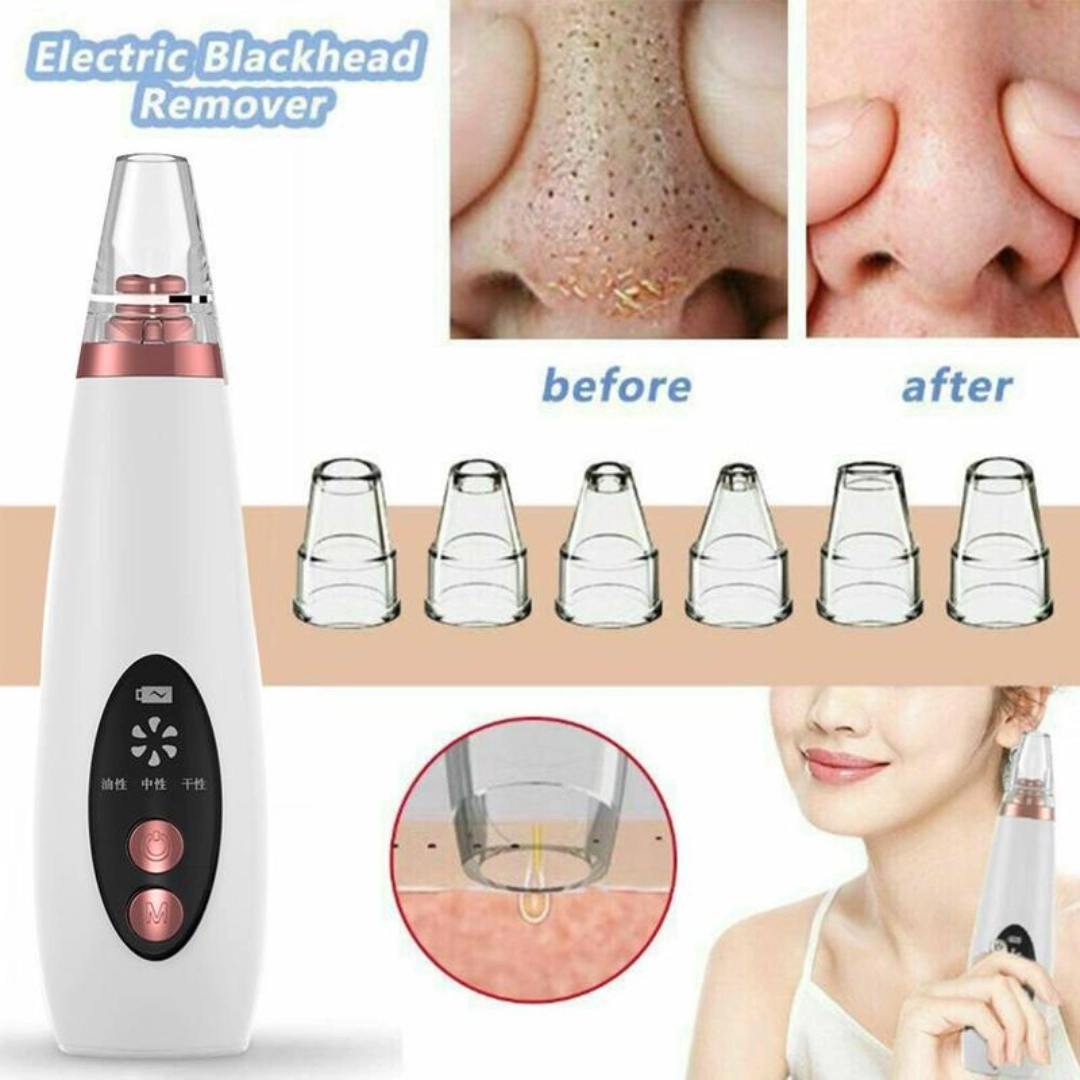 Remove Acne Instrument Blackhead Remover Instrument Black Dot Remover Acne Vacuum Suction Face ...